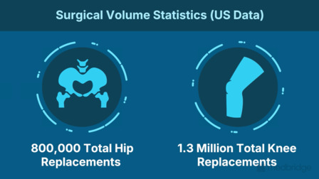Optimizing Gait After Hip Arthroplasty