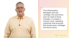 The Biology of Osteoarthritis