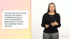 Associated Conditions With Cranial and Cervical Pathologies in HSD/EDS