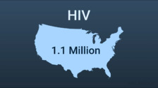 HIV and AIDS: An Overview